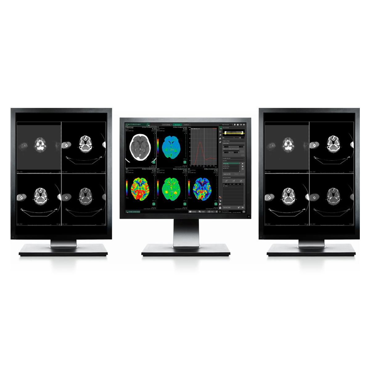 Fujifilm Synapse High-Speed PACS System