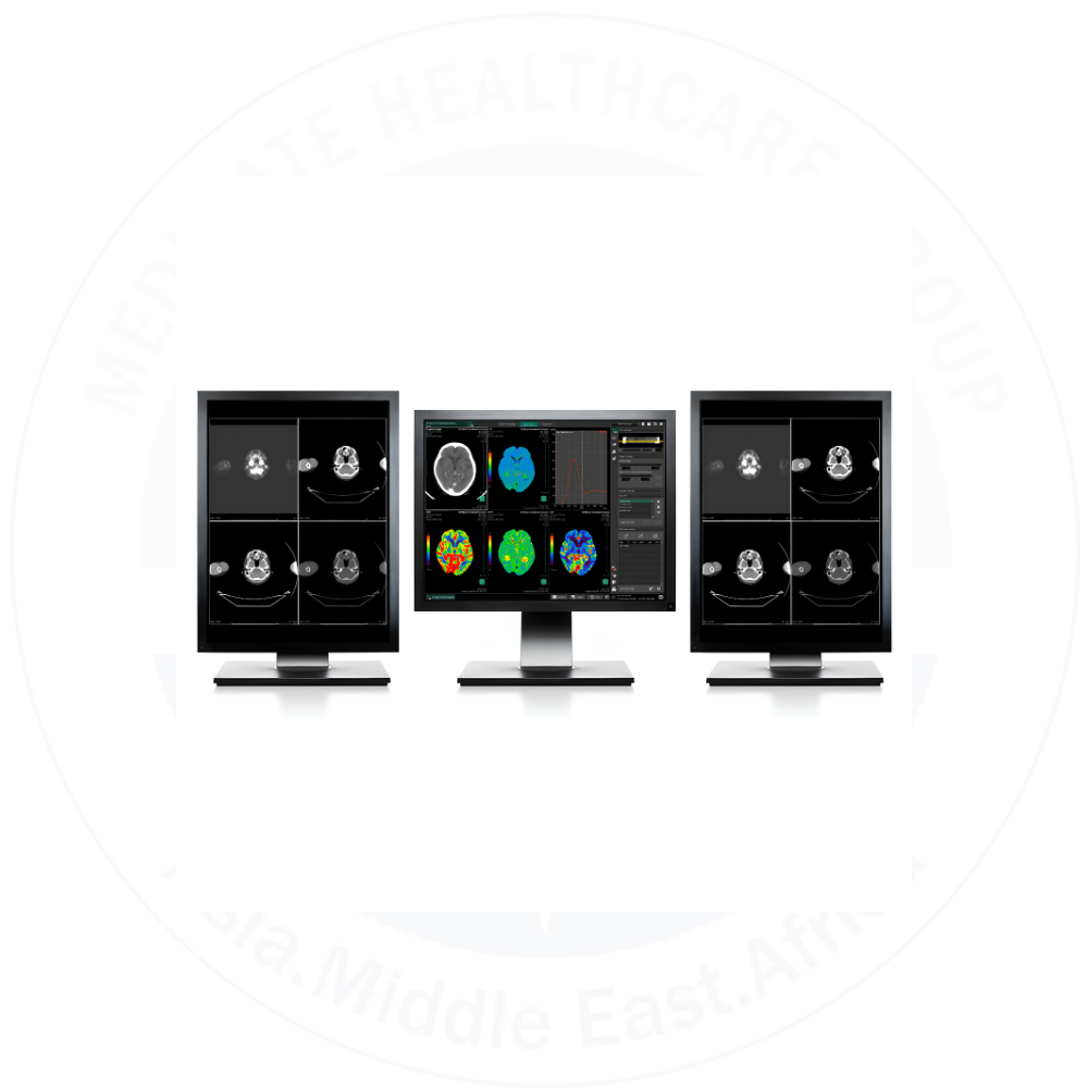 High‑Speed PACS (Picture Archiving and Communication System)